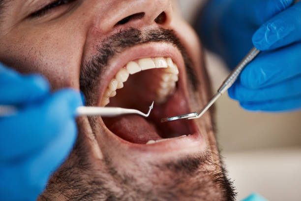 Best Emergency Dental Care for Trauma or Injury in Rural Retreat, VA