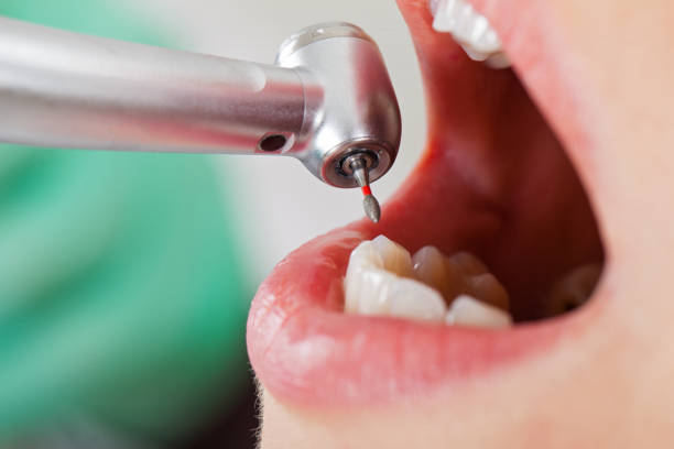 Best Emergency Broken Tooth Repair in Rural Retreat, VA